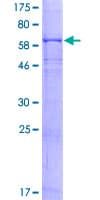 Human FCGR1A / CD64 Protein (Recombinant GST)