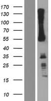 Human IKZF3 / AIOLOS Protein (Over-Expression Lysate Myc-DDK (Flag))