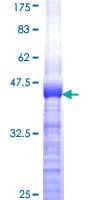 Human IRS4 Protein (Recombinant GST, N-terminus)