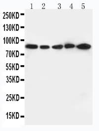 ITGB2 / CD18 Antibody (aa732-748)
