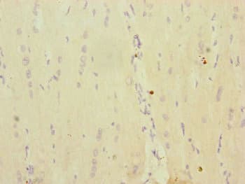 Polyclonal Rabbit anti-Human MRPS16 Antibody (IHC, WB)