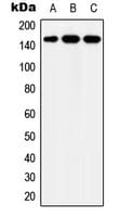 Polyclonal Rabbit anti-Human YEATS2 Antibody (Internal, WB)