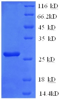Mouse IL2RB / CD122 Protein (Recombinant His)