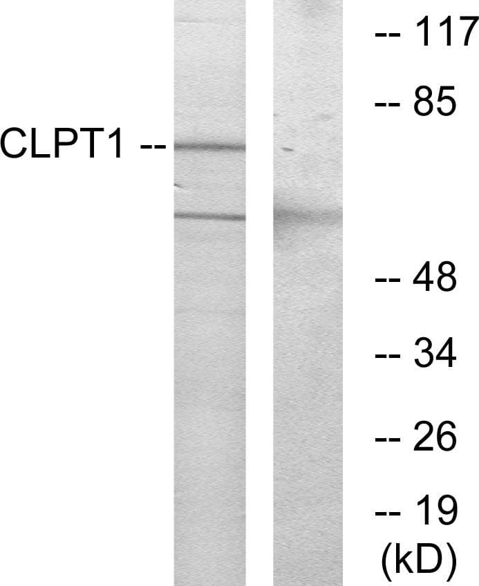 Polyclonal Rabbit anti-Human CLPTM1 Antibody (WB)