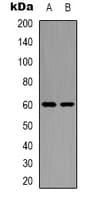 Polyclonal Rabbit anti-Human GRB10 Antibody (N-Terminus, IHC, IF, WB)