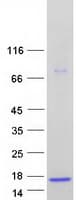 Human ASXL1 Protein (Recombinant Myc-DDK (Flag))