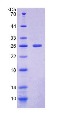 Mouse NCR1 / NKP46 Protein (Recombinant His-T7)