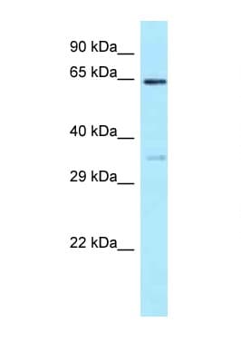 Polyclonal Rabbit anti-Human EIF3D Antibody (aa124-173, WB)