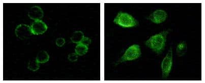 Monoclonal Mouse anti-Human TYRO3 Antibody (clone 1C10E8, 9A3F2, IF, WB)