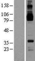 Human IL4R / CD124 Protein (Over-Expression Lysate Myc-DDK (Flag))