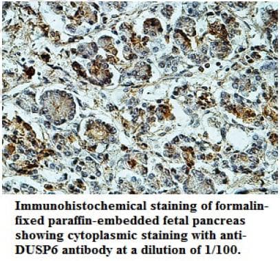 IHC-plus™ DUSP6 / MKP3 Antibody (aa14-201)