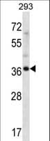 ANKRD60 Antibody (aa261-289)