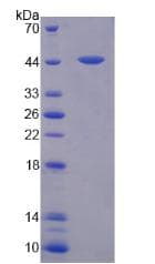 Human AQP4 / Aquaporin 4 Protein (Recombinant His-GST)