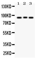 SEMA3A / Semaphorin 3A Antibody (aa550-771)