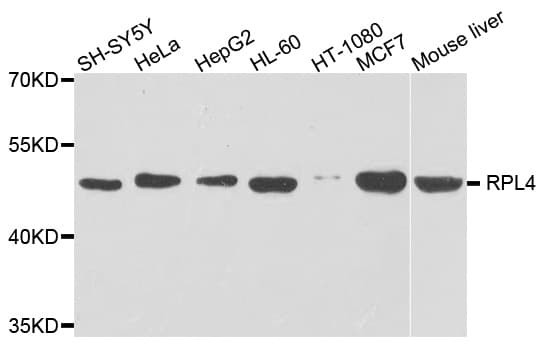 Polyclonal Rabbit anti-Human RPL4 / Ribosomal Protein L4 Antibody (IHC, WB)