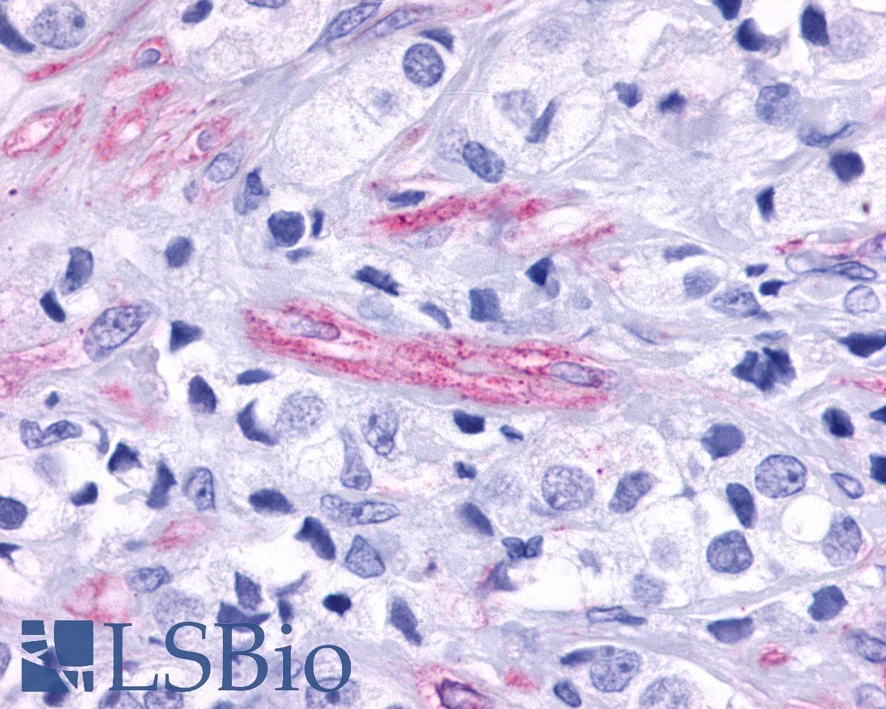 IHC-plus™ Polyclonal Rabbit anti-Human ADGRA2 / GPR124 Antibody (N-Terminus, IHC)