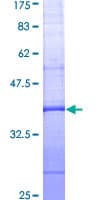 Human ANXA1 / Annexin A1 Protein (Recombinant GST, N-terminus)