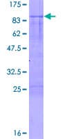 Human IRX3 Protein (Recombinant GST)