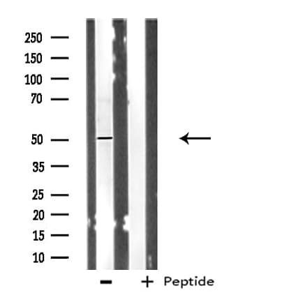 Polyclonal Rabbit anti-Human POLD3 Antibody (IF, WB)