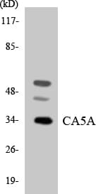 Polyclonal Rabbit anti-Human CA5A / Carbonic Anhydrase VA Antibody (aa164-213, WB)