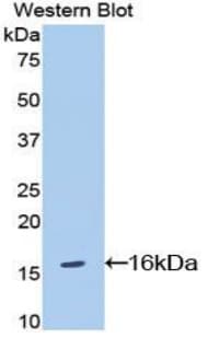 CDw218a / IL18R1 Antibody (aa391-518, APC)