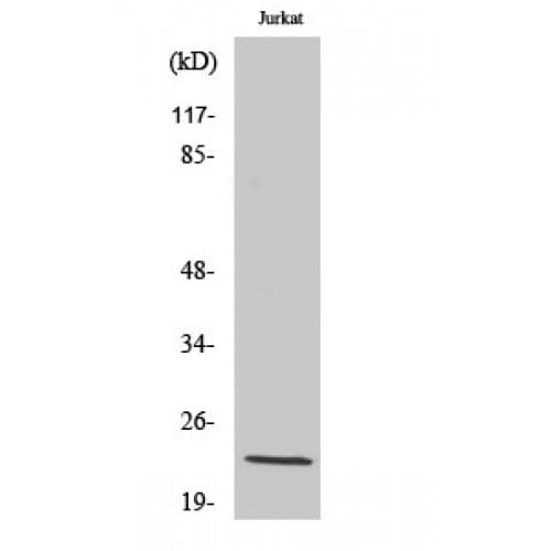 SOCS2 Antibody (Internal)