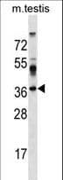 SURF4 Antibody (aa211-237)