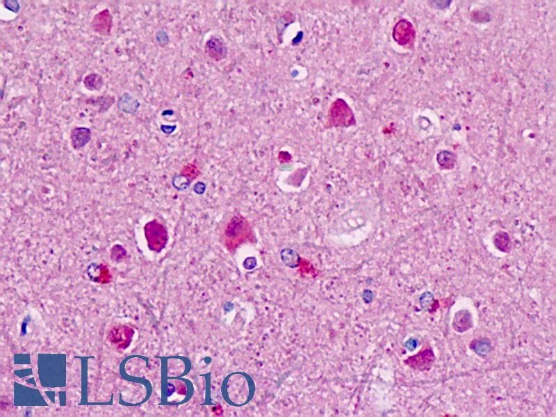 IHC-plus™ CUL1 / Cullin 1 Antibody (Internal, clone EPR3102Y)