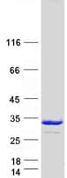 Human PSMD9 / 26S Proteasome Protein (Recombinant Myc-DDK (Flag))