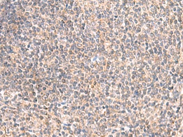 Polyclonal Rabbit anti-Human GIMAP2 Antibody (IHC)