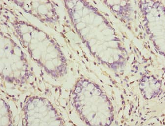 Polyclonal Rabbit anti-Human SH3GL1 / EEN Antibody (IHC)