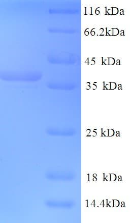 Mouse MAP2 Protein (Recombinant His)