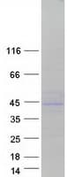 Human CYB5R3 / B5R Protein (Recombinant Myc-DDK (Flag))