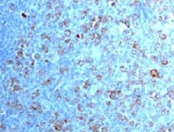 CDK1 / CDC2 Antibody (clone CDVC2-1)