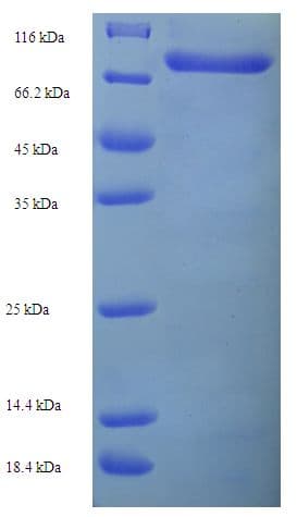 Mouse TRIM21 / RO52 Protein (Recombinant His-SUMO)