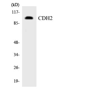 CDH2 / N Cadherin Antibody (aa696-745)