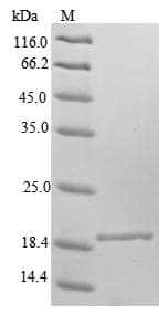 Mouse FXN / Frataxin Protein (Recombinant 6His, N-terminus)