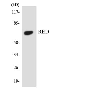Polyclonal Rabbit anti-Human Cytokine IK Antibody (aa506-555, WB)