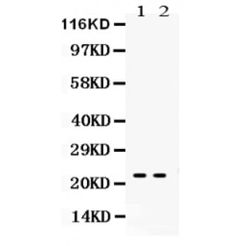 LCN2 / Lipocalin 2 / NGAL Antibody (aa21-200)