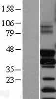 Human FOSB Protein (Over-Expression Lysate Myc-DDK (Flag))