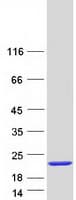Human UBE2I / UBC9 Protein (Recombinant Myc-DDK (Flag))