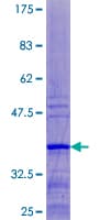 Human RPL37 / Ribosomal Protein L37 (Recombinant GST)