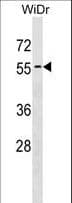 ATG4D Antibody (aa321-346)