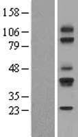 Human CD79A / CD79 Alpha Protein (Over-Expression Lysate Myc-DDK (Flag))