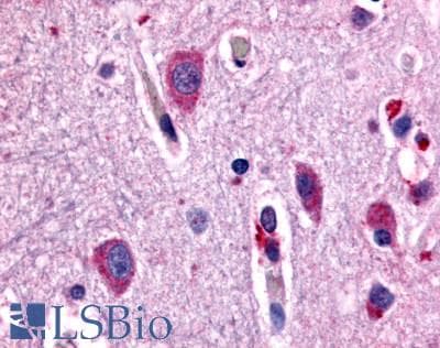 IHC-plus™ CHRM2 / M2 Antibody (Cytoplasmic Domain)