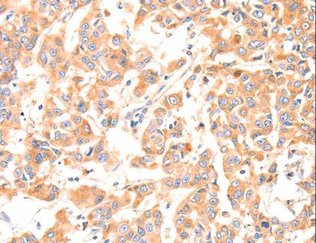 F13A1 / Factor XIIIa Antibody