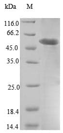 Human DLAT / PDC-E2 Protein (Recombinant 6His, N-terminus)