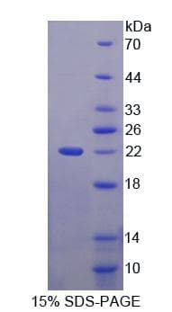 Human Cnpy2 / TMEM4 Protein (Recombinant His-T7)