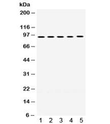 MCM8 Antibody