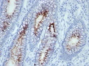 CEA / Carcinoembryonic Antigen Antibody (clone SPM506)